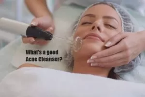 Acne Cleanser