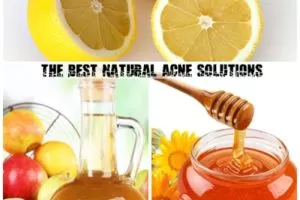Best Natural Acne Solutions