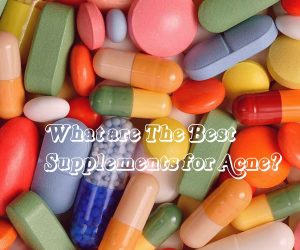 Supplements for Acne