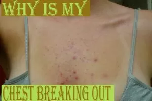 Chest Breaking Out