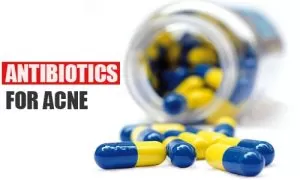 Antibiotics for Acne