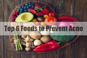 prevent acne