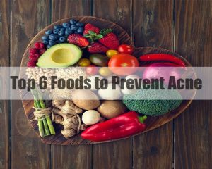 prevent acne